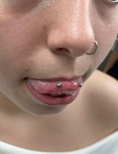 Asesoramiento para piercing en Zabalburu antes de la colocación